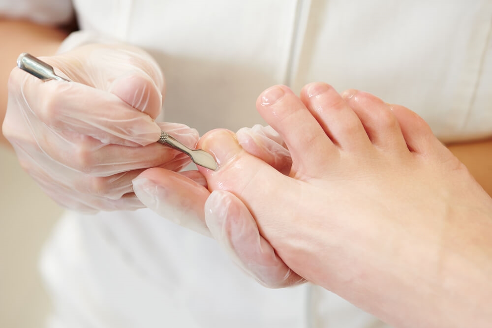 Pédicure médicale